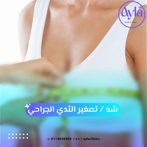 شد / تصغير الثدي الجراحي