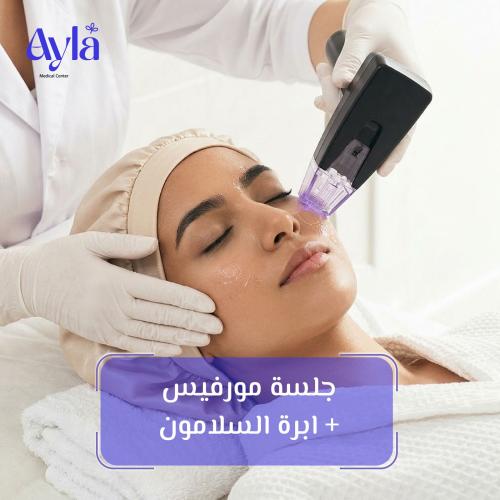 جلسة مورفيس + ابرة السلامون