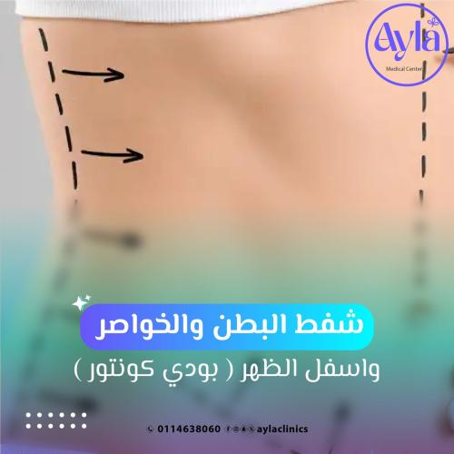شفط البطن والخواصر واسفل الظهر ( بودي كونتور )