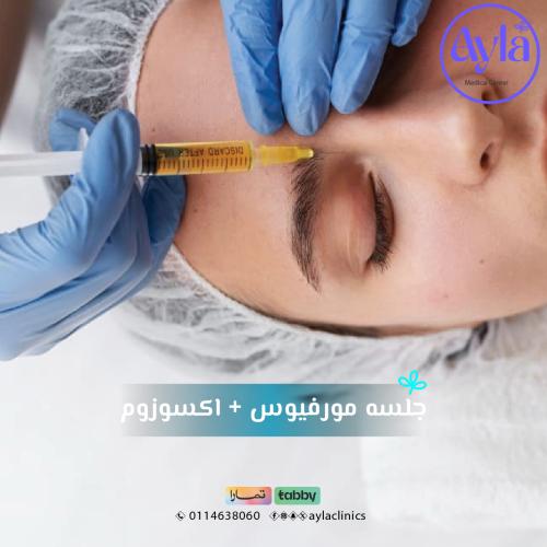 جلسة مورفيوس + اكسوزوم