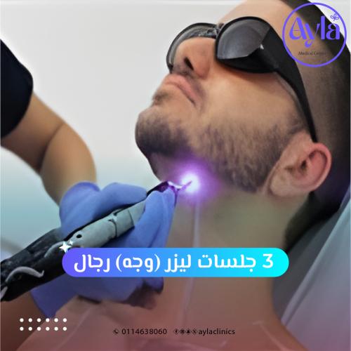 3 جلسات ليزر وجه رجال