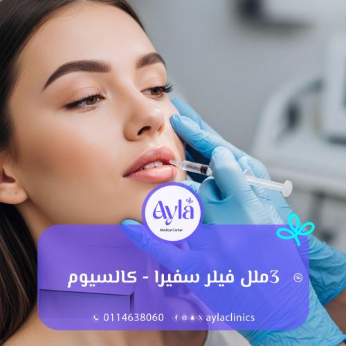 3 مل فيلر سفيرا - كالسيوم