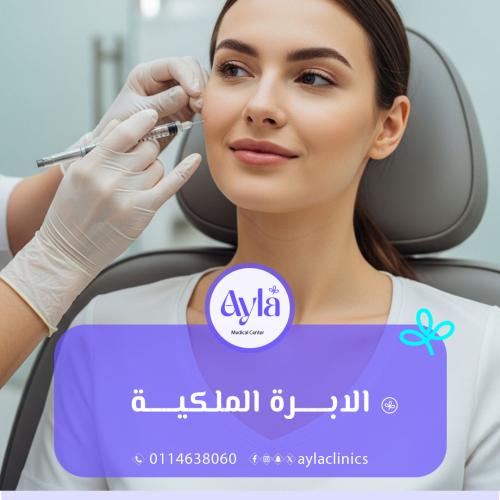 الابرة الملكية