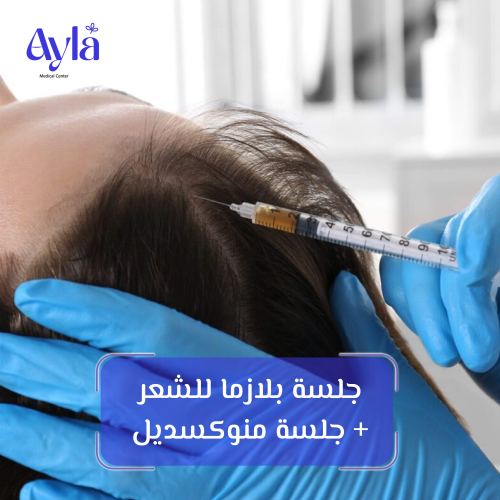 جلسة بلازما للشعر + جلسة منوكسديل
