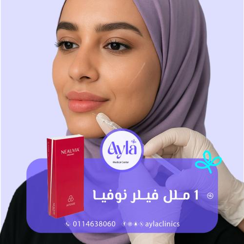 1 مل فيلر ( نوفيا )