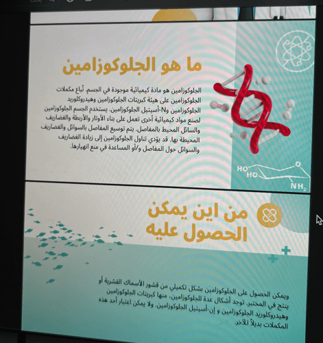 التأثيرات الوقائية للجلوكوزأمين \ 16