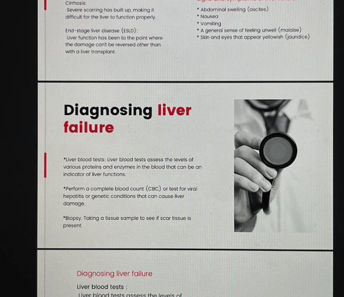Jaundice, Liver cell failure \ 21 ص