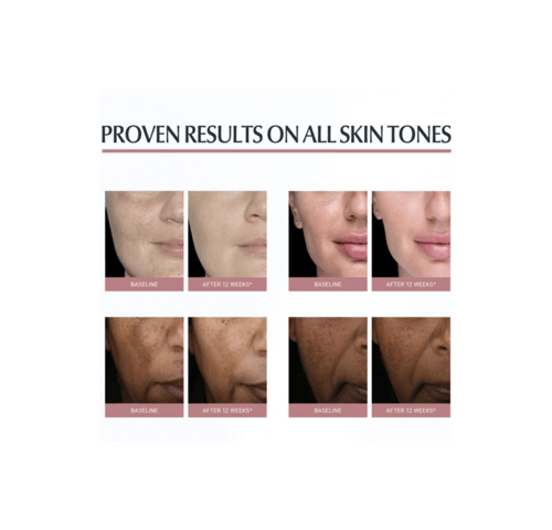 يوسيرين ايفن بجمنت بيرفكتور السيروم المزدوج الفاعل...