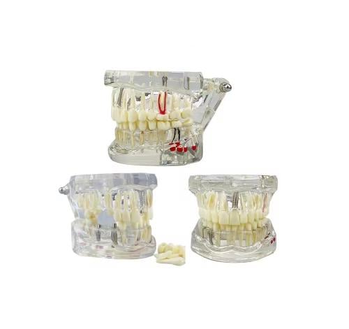DENTAL STUDY MODEL