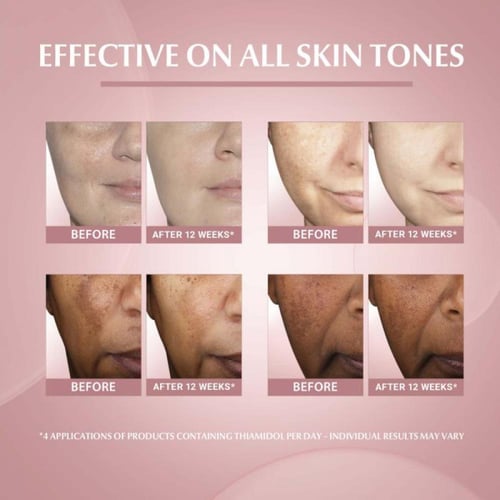 eucerin يوسيرين ايفن بجمنت بيرفكتور الكريم الليلي...