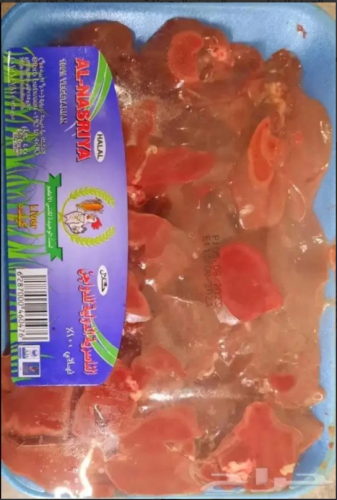 كبد الناصرية