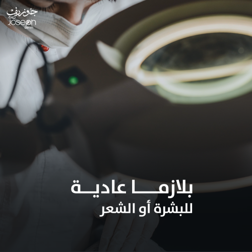 جلسة بلازما عادية