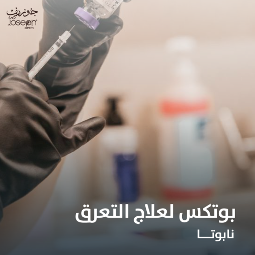 بوتوكس للتعرق المفرط نابوتا