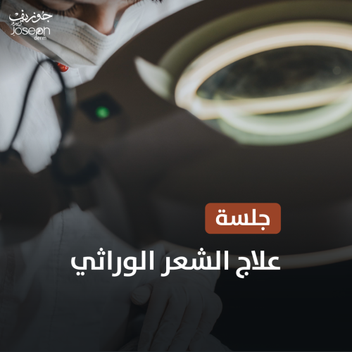 جلسة علاج الشعر الوراثي