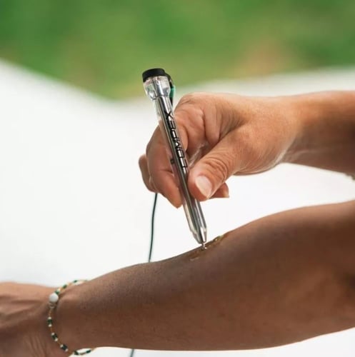 قلم تحفيز العضلات من كومبكس - COMPEX MOTOR POINT P...