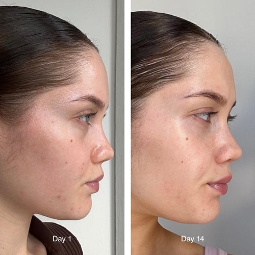 رود تونر الحليب glazing milk