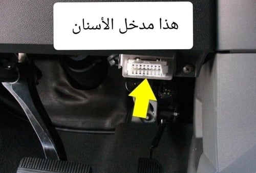 عداد سرعة الكتروني