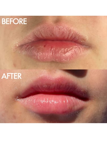 لانو ليبس مرهم سوبر بالم الأصلي متعدد الأغراض 101(...