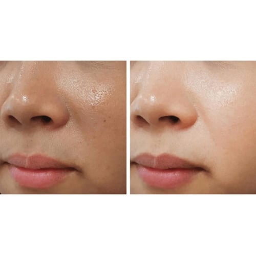 ايه سي ام - ديب وايت ادفانسيد كريم مزيل للبقع والت...