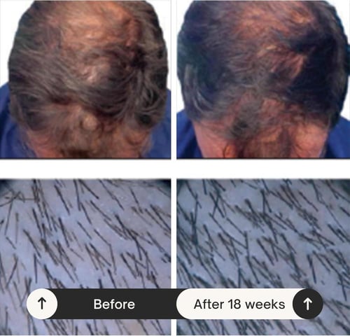 سائل مكثف الشعر جينسنج وكافيين من راوش 30 مل