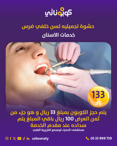 حشوة تجميلية لسن خلفي (ضرس)- مستشفى الحمراء او مجم...