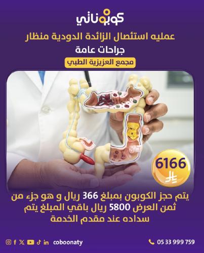 عملية استئصال الزائدة الدودية منظار - مجمع العزيزي...