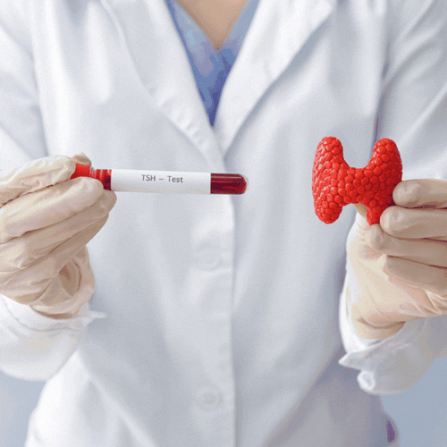 تحليل الغدة الدرقية TSH - مختبرات البركة الطبية -...