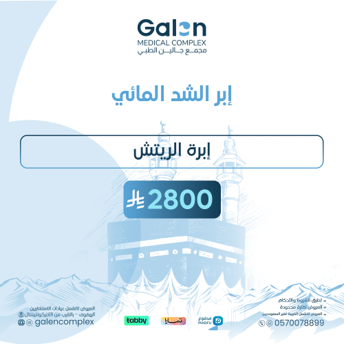 ابرة الريتش