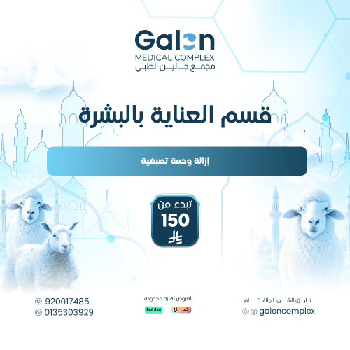 إزالة وحمة تصبغية