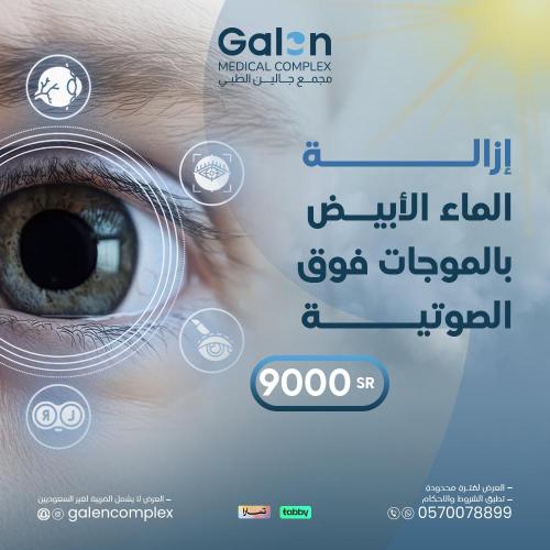 إزالة الماء الأبيض بالموجات فوق الصوتية(غيرشامل ال...