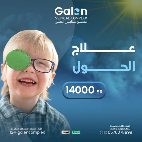 علاج الحول (غيرشامل الضريبة لغير السعوديين)