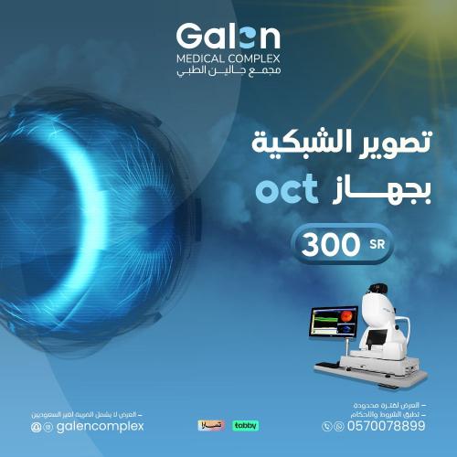 تصوير الشبكية بجهاز oct
