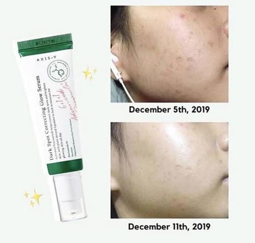 سيروم أكسيس واي لتفتيح البقع السوداء- 50ml