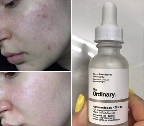 سيروم مكافحة التصبغات ذا اورديناري Niacinamide 10%...