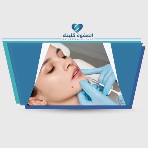 جلسة انوفيال لتفتيح وترطيب الهالات