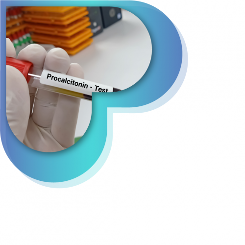 تحليل البرولاكتين ( هرمون الحليب )