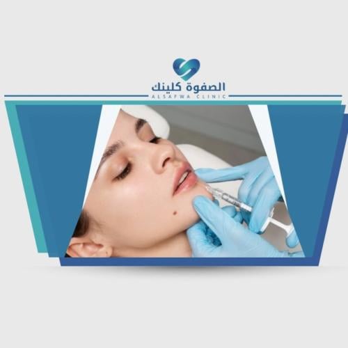 ابرة بروفايلو للنضارة البشرة