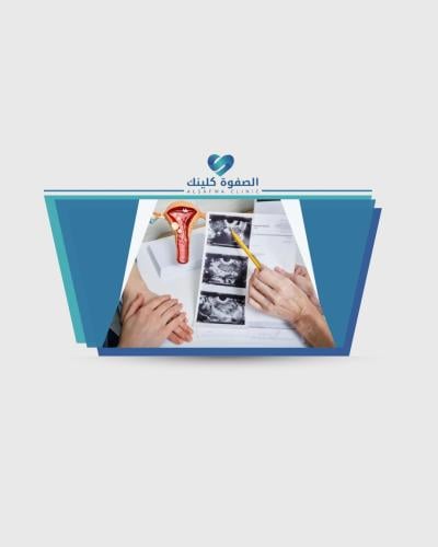 سونار عادي وكشف مجانا