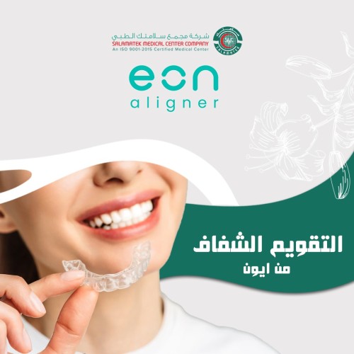 التقويم الشفاف آيون (حالة بسيطة) 2023343