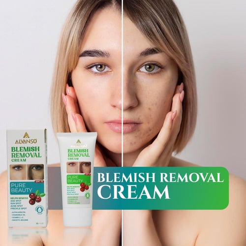 ألفانسو كريم ازالة العيوب Alvanso BLEMISH REMOVAL...