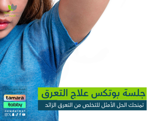 جلسة بوتكس لعلاج التعرق – تخلص من الإحراج واستعد ث...
