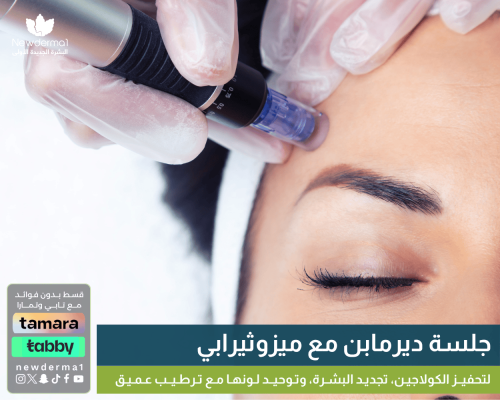 جلسة ديرمابن مع ميزوثيرابي لتجديد ونضارة البشرة