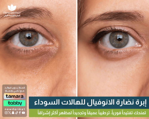 إبرة إنوفيال للهالات تحت العين 1 مل | تفتيح وترطيب