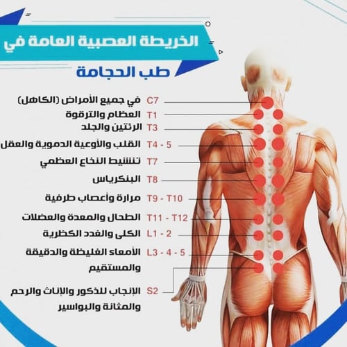 حجامة اصفر 12 كاسه
