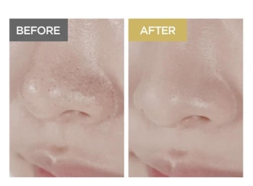 سكين 1004 - زيت التنظيف الخفيف من مدغشقر سنتيلا Sk...