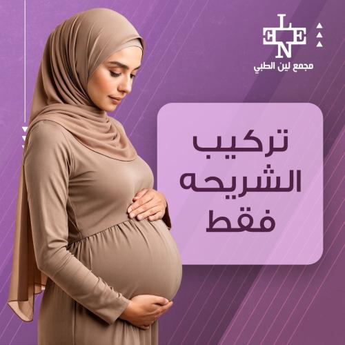 تركيب شريحة فقط