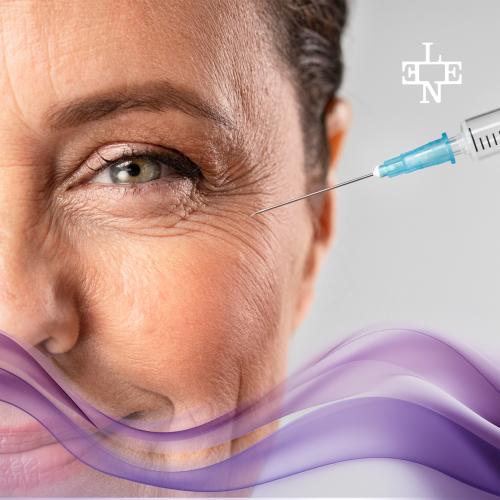 بوتوكس التجاعيد حول العين - ( سايكس أو أرجان )