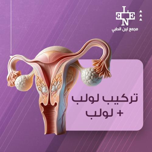 تركيب لولب +لولب