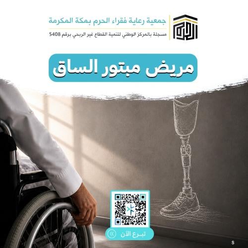 A patient with a leg amputation