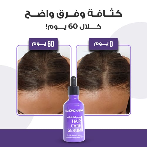 طقم الموند هير لتطويل وتكثيف الشعر للنساء مع Capil...